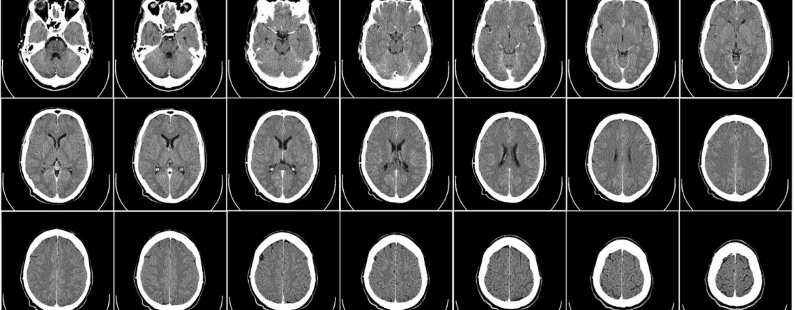 How Mental Illness Might Affect Child Custody Rights